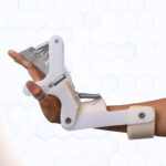 Dynamic Radial Palsy Splint
