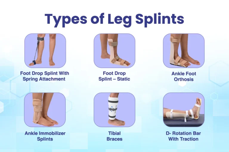 Types of Leg Splints: A Complete Guide